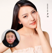 貴陽(yáng)激光美白能維持多久？