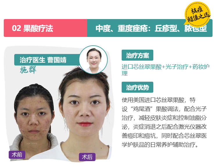 經(jīng)常長(zhǎng)痘，美萊果酸祛痘效果怎么樣
