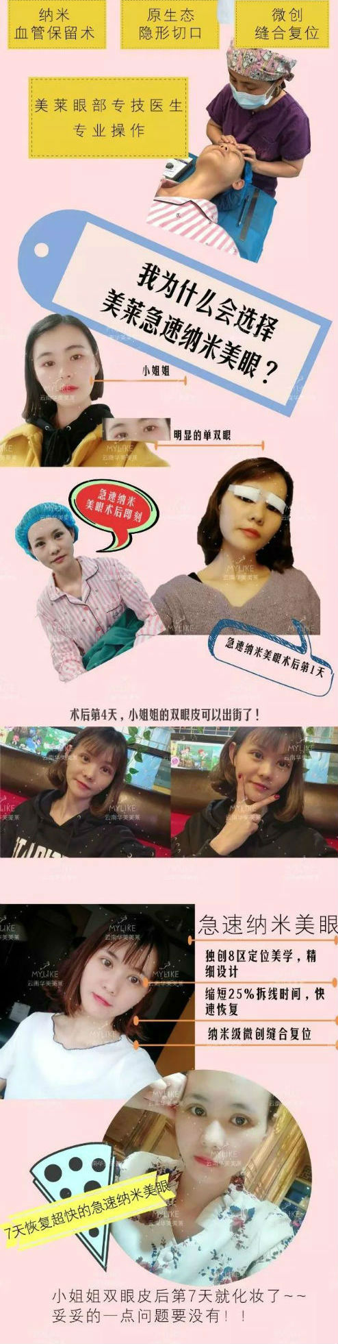 急速納米美眼維持時(shí)間有多長