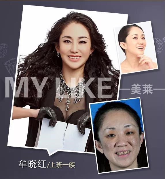 化妝品會讓黃褐斑增長嗎，預(yù)防黃褐斑有哪些方法