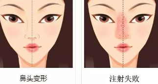 廣州韓式隆鼻哪個機(jī)構(gòu)好