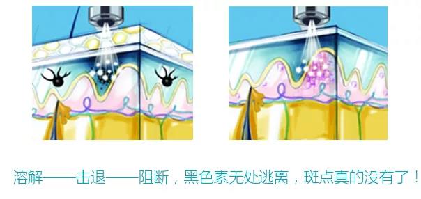 長(zhǎng)斑和大姨媽有沒(méi)有關(guān)聯(lián)？