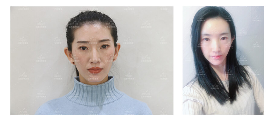 2011年環(huán)球游艇模特大賽十佳及單項獎小姐姐必做的醫(yī)美項目?。∶廊R雙十一get好物推薦