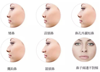打玻尿酸鼻子會(huì)變寬，是不是真的？