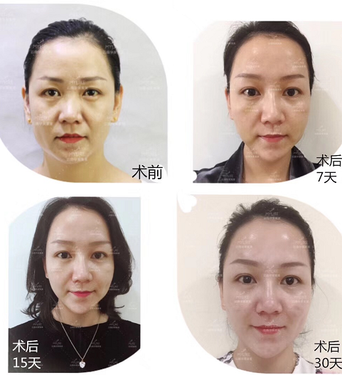優(yōu)品聚獻(xiàn)·超級新品周|這份爆款清單務(wù)必收下！