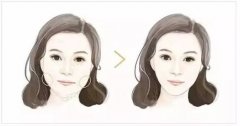 上海豐太陽(yáng)穴有哪些方式