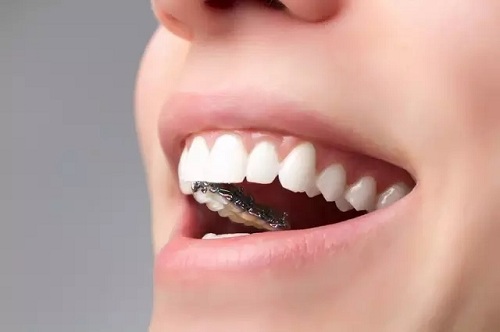 <a href='/suz/' target='_blank'><u>蘇州美萊</u></a>矯正牙齒能提升顏值？是真的！