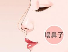 假體隆鼻的有無后后遺癥？假體隆鼻的材料有無副作用?