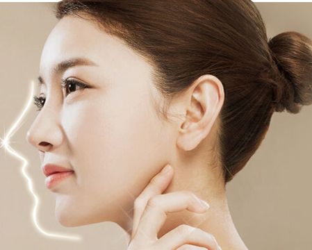 剛滿18歲的女生能去做玻尿酸隆鼻嗎？有什么危害嗎？