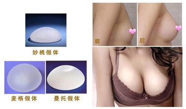 佛山假體隆胸后可以母乳嗎？