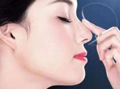 成都假體隆鼻的效果維持時間有多長？