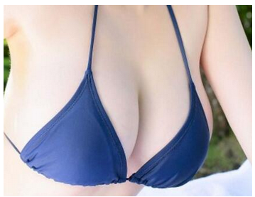 杭州假體豐胸手術(shù)會(huì)會(huì)造成危害么？