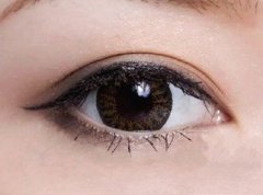 眼袋和臥蠶的區(qū)別？