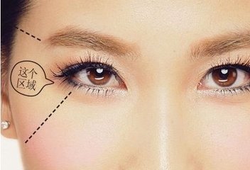武漢做豐太陽(yáng)穴多少錢？