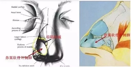 『雙側(cè)耳軟骨鏡像移植』男友“捏鼻殺”是什么感覺？