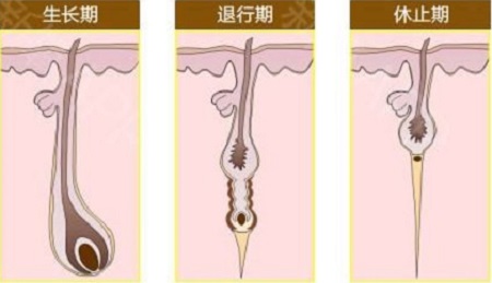 冰點(diǎn)脫腋毛后還會復(fù)發(fā)嗎