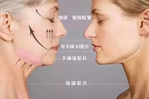 天使精*開(kāi)啟逆時(shí)空時(shí)代，你為新年亮相準(zhǔn)備好了嗎？