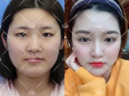 雙眼皮真的可以讓一部分人擁有神仙顏值！