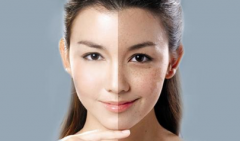 光子嫩膚價(jià)格是多少？