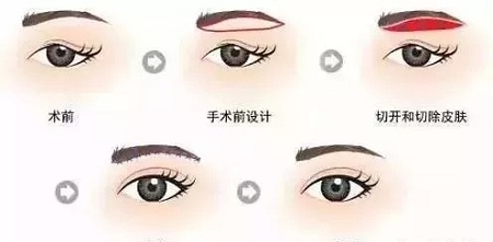 眼部衰老的三大“殺手”！