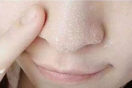 深圳做鼻頭整形要多少錢？