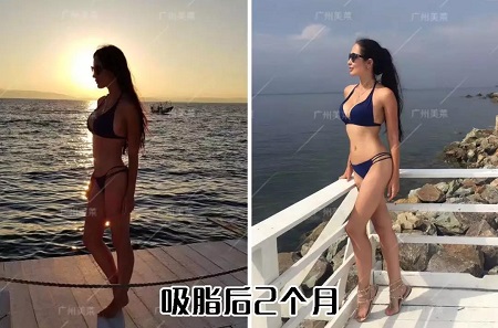 瘦腿很難嗎？1招教你變身筷子腿！