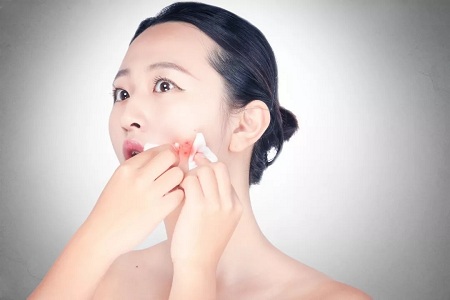 這些靠譜的去痘印方法，“萊”解決你的煩憂~
