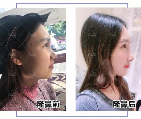 從萬人嫌到萬人迷，只悄悄變了這個部位？