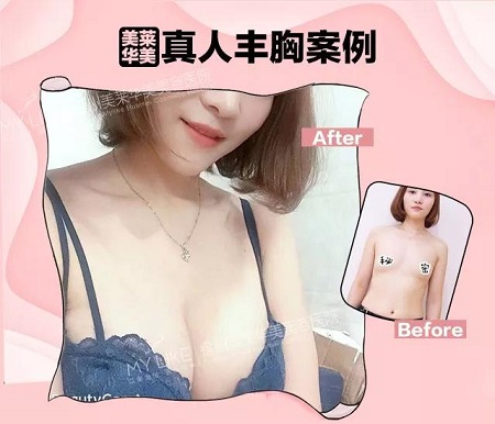 “從小喝到大”的椰汁能豐胸？