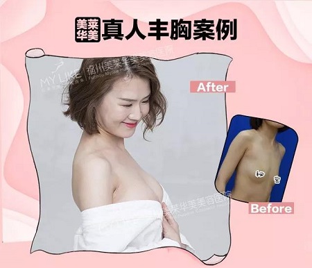 “從小喝到大”的椰汁能豐胸？那我剛隆的胸面子往哪放