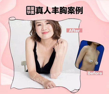 “從小喝到大”的椰汁能豐胸？
