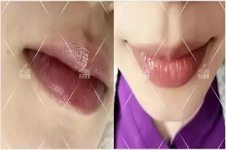 想過(guò)嗎？為啥有人的體毛多有的人少？