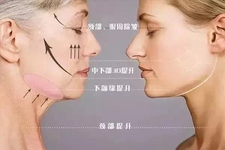 長了痘為啥消不下去??？