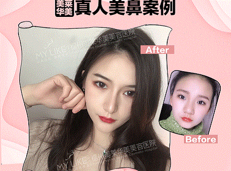 她曾丑到無人問津，現(xiàn)在卻擁有魔鬼身材，簡直是“行走的美人魚”