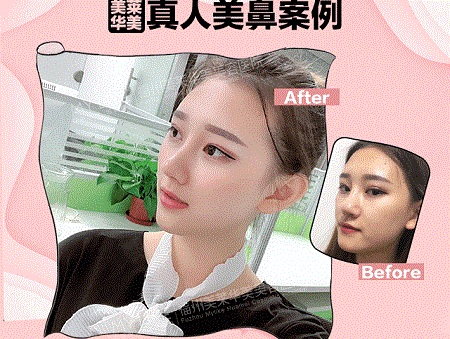 現(xiàn)在卻擁有魔鬼身材，簡直是“行走的美人魚”