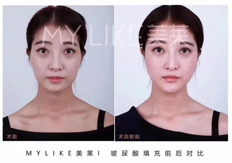 卻比喬妹還能收割男神？！