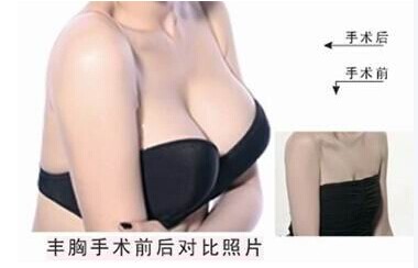 <a href='/tj' target='_blank'><u>天津整形</u></a>隆胸手術(shù)多少錢？
