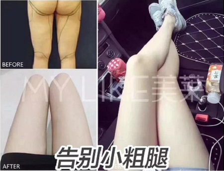 簡(jiǎn)單幾招瘦小肚子，火速收藏！