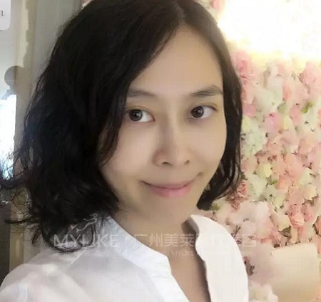 10分鐘打玻尿酸，即刻效果驚人！