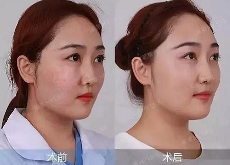 全日本女生較想整容的范本竟是她？！