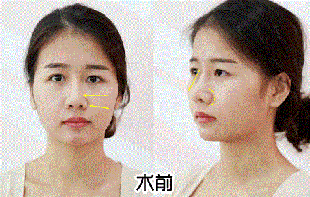 換對(duì)鼻子宛如換了一張臉，