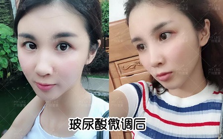 阿姨臉化身顏值擔(dān)當(dāng)，微調(diào)效果到底有多美？