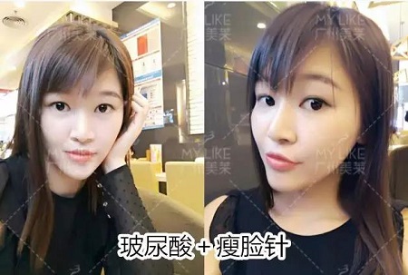 微調(diào)效果到底有多美？