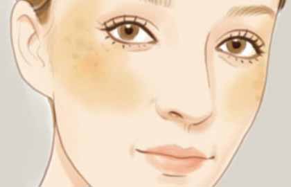 廣州美萊醫(yī)療美容醫(yī)院祛斑效果好嗎？