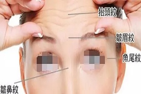 沈陽(yáng)做拉皮除皺多少錢