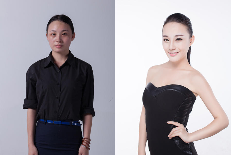 昆明玻尿酸的價(jià)格是多少？