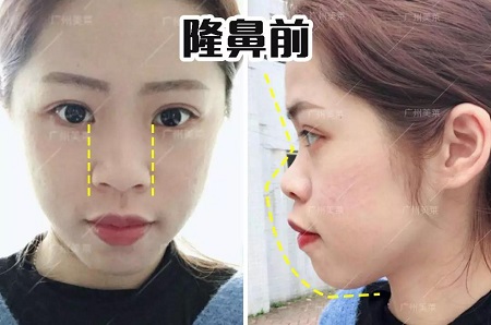 只差1個(gè)鼻的距離！