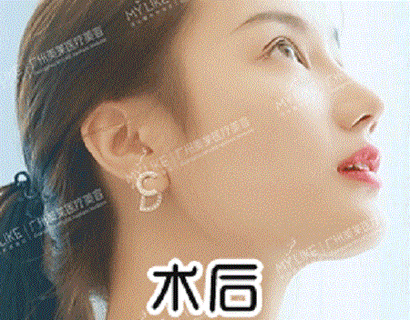  你與仙女只差一個(gè)鼻子的距離！