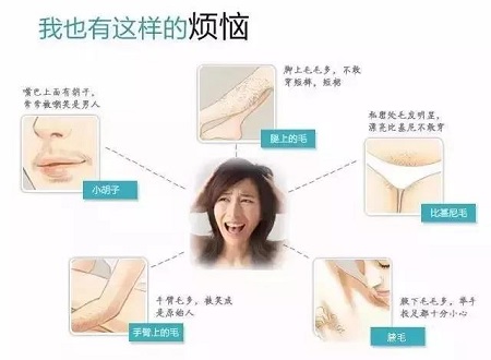 脫毛年卡38元起 |脫掉尷尬,秀出迷人好身材！