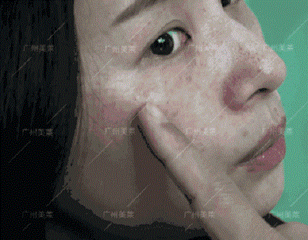 what?護(hù)膚品祛斑不成，反成熒光臉？